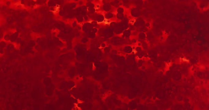 Small red blood cells in fluid
