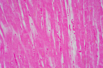 Histology of human cardiac muscle under microscope view for education.