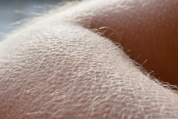 Goose bumps - human skin reaction on the cold