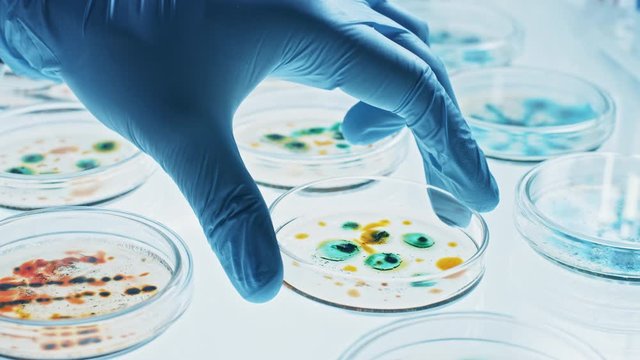 Scientist Works with Petri Dishes with Various Bacteria, Tissue and Blood Samples. Concept of Pharmaceutical Research for Antibiotics, Curing Disease with DNA Enhancing Drugs. Moving Close-up Macro