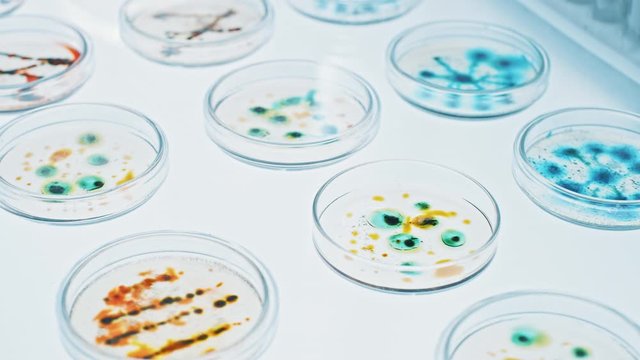 Microbiology Laboratory: Petri Dishes with Various Bacteria Samples, Pipette Drops Liquid Solution