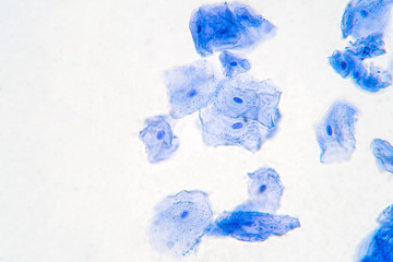 Human Cheek Epithelial Cells. The tissue that lines the inside of the mouth is known as the basal mucosa and is composed of squamous epithelial cells.