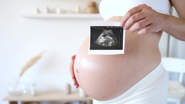 Pregnant Woman Holding Ultrasound Picture On Her Tummy