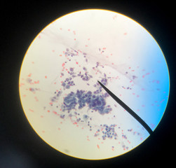 Cells in reproductive female cytology and histology concept.