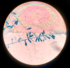 Close up macro conidia of fungi.