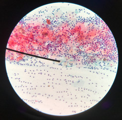 Cells in reproductive female cytology and histology concept.