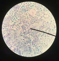 Cells in reproductive female cytology and histology concept.
