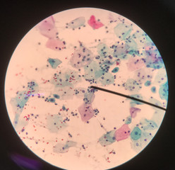 Cells in reproductive female cytology and histology concept.