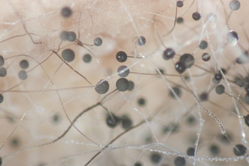 Backgrounds Colony Characteristics of Rhizopus (bread mold) is a genus of common saprophytic fungi, Rhizopus (bread mold) under the microscope.