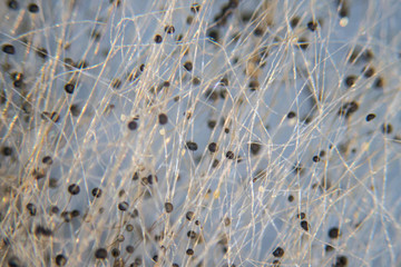 Fototapeta na wymiar Backgrounds Colony Characteristics of Rhizopus (bread mold) is a genus of common saprophytic fungi, Rhizopus (bread mold) under the microscope.