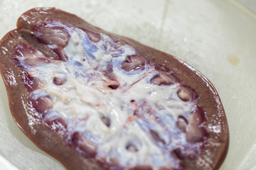 Study and learn about kidney in laboratory.