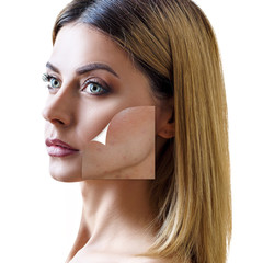 Layer with bad skin unstick from good healthy skin.