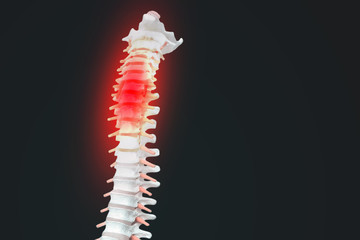 Realistic skeletal human spine and vertebral column or intervertebral discs on a dark background....