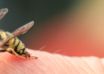 small striped dangerous insect wasp has stung a man in the skin and is trying to crawl away
