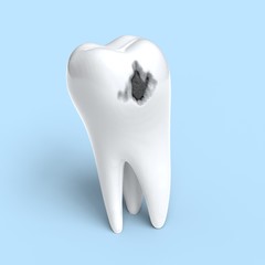 Damaged tooth with caries. 3d illustration