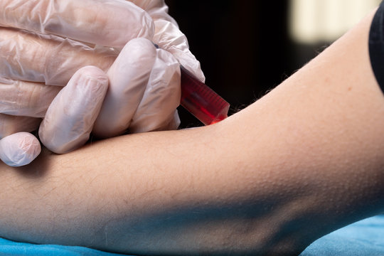 therapeutic injections: concept of botulinum neurotoxin and its use
