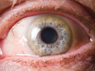 Human eye close up medical detail