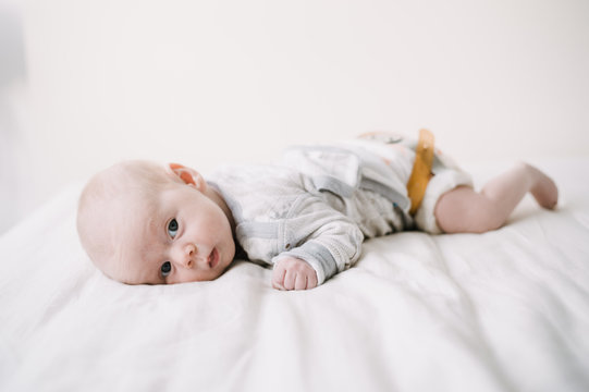 Baby with Hip Dysplasia