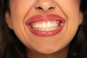 closeup of woman showing her healthy teeth