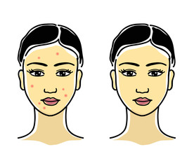 Girl with acne on her face. Girl with clean skin. Portrait. Vector illustration.