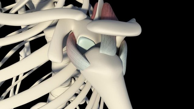 Rotator Cuff Tear