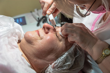 Obraz na płótnie Canvas A cosmetic procedure with ultrasonic cleaning of the skin of the face is performed for an aged woman. Instrumental effect on the surface of the skin. A series of sequential operations.