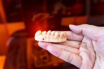 3d printer from a photopolymer material.