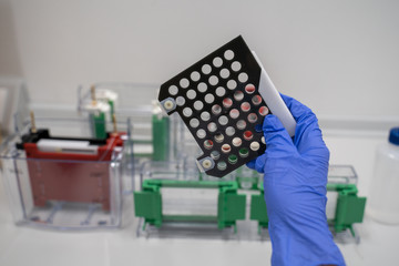 The hand of the researcher holds the Gel holder. Gel holder cassette is a transfer blotting...