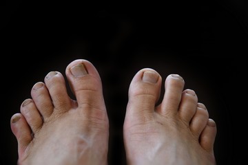  dirty old feet on black background