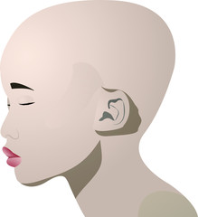 Concept girl with autoimmune disease, alopecia