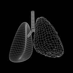 Healthy and sick lung with trachea bronchi internal organ human. Pulmonology medicine science technology concept. Wireframe low poly mesh vector illustration