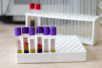 Test tubes with blood. Medical laboratory.
