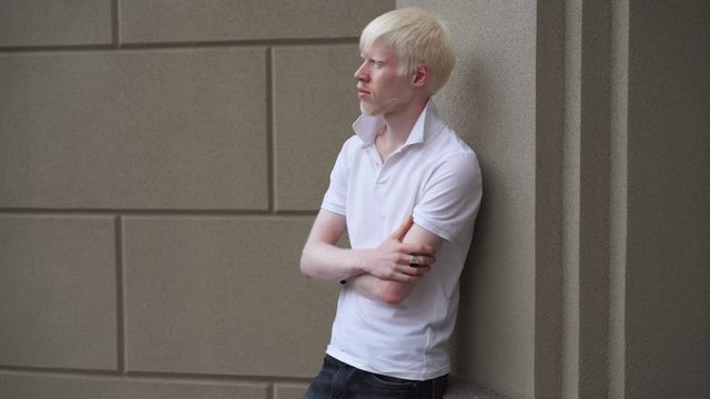 portrait of an albino man outdoor dressed t-shirt standing near building. abnormal deviations. unusual appearance