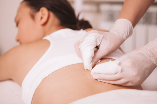 Cropped shot of a professional cosmetologist removing blackheads on the back of a woman. Beautician cleaning pores on the body of a female client