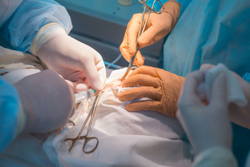 close-up, a team of pediatric surgeons perform surgery for ear lymphadenitis. Oncologists perform a puncture for diagnosis