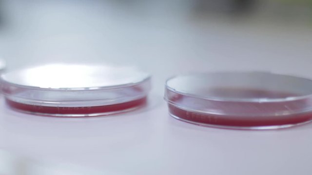 Petrischale mit Blutagar N&auml;hrmedium