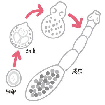 エキノコックス