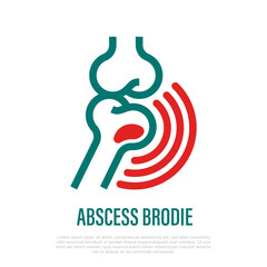 Brodie abscess thin line icon. Inflammation and pain in joint. Vector illustration for medical clinic.