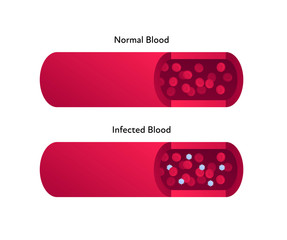 Microbiology medicine concept. Vector flat illustration. Normal and virus infected blood vessel isolated on white. Design element for banner, poster, background, web, healthcare infographic.