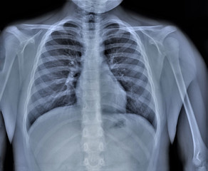 normal radiography of chest organs in direct projection, traumatology and orthopedics, pulmonology
