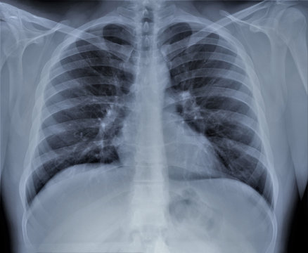 normal radiography of chest organs in direct projection, traumatology and orthopedics, pulmonology