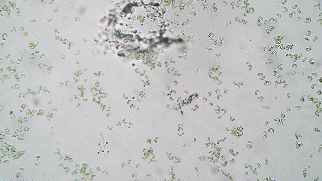 The amoeba moves fast in a drop of water timelapse. Theme of laboratory biological research under microscope. Microscopic protozoa in a drop of water under magnification. Microcosm close-up.