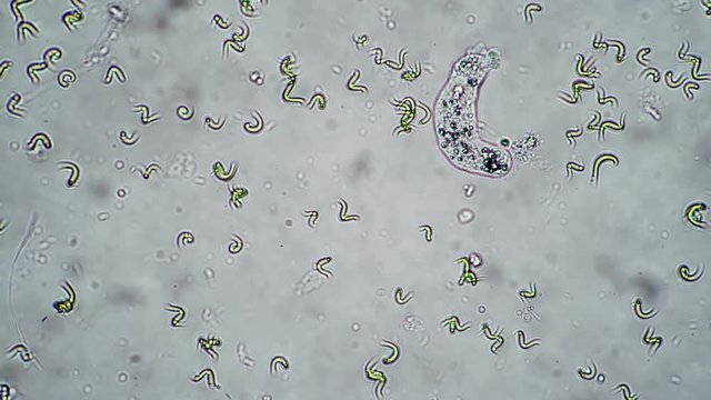 Amoeba moving in the water between the algae timelapse. Theme of laboratory biological research under microscope. Microscopic protozoa in a drop of water under magnification. Microcosm close-up.