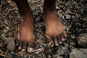 poor child or beggar begging you for help sitting at dirty slum. concept for poverty or hunger people,human rights,donate and charity for underprivileged children in third world