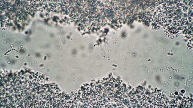 Lactic acid lactobacilli from milk sourdough useful for the intestine. The theme of lactic acid foods is under 1000x magnification. Bacteria useful for the human body from yogurt.