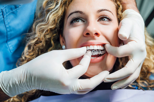 Doctor putting a clear dental aligner to the patient woman