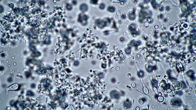 Research and search for milk bacteria under a microscope. Microcosmic background. The theme of lactic acid foods is under 1000x magnification. Bacteria useful for the human body from yogurt.