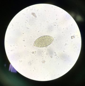 Egg parasite human in stool examination.