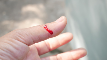 Fresh wound with blood in finger.