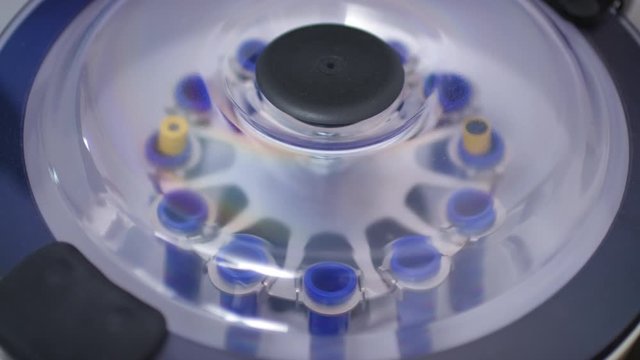 Close up shot of blood samples spinning in centrifuge during fractionation process. Lab worker turning it off, opening lid and taking off test tubes for analyzing